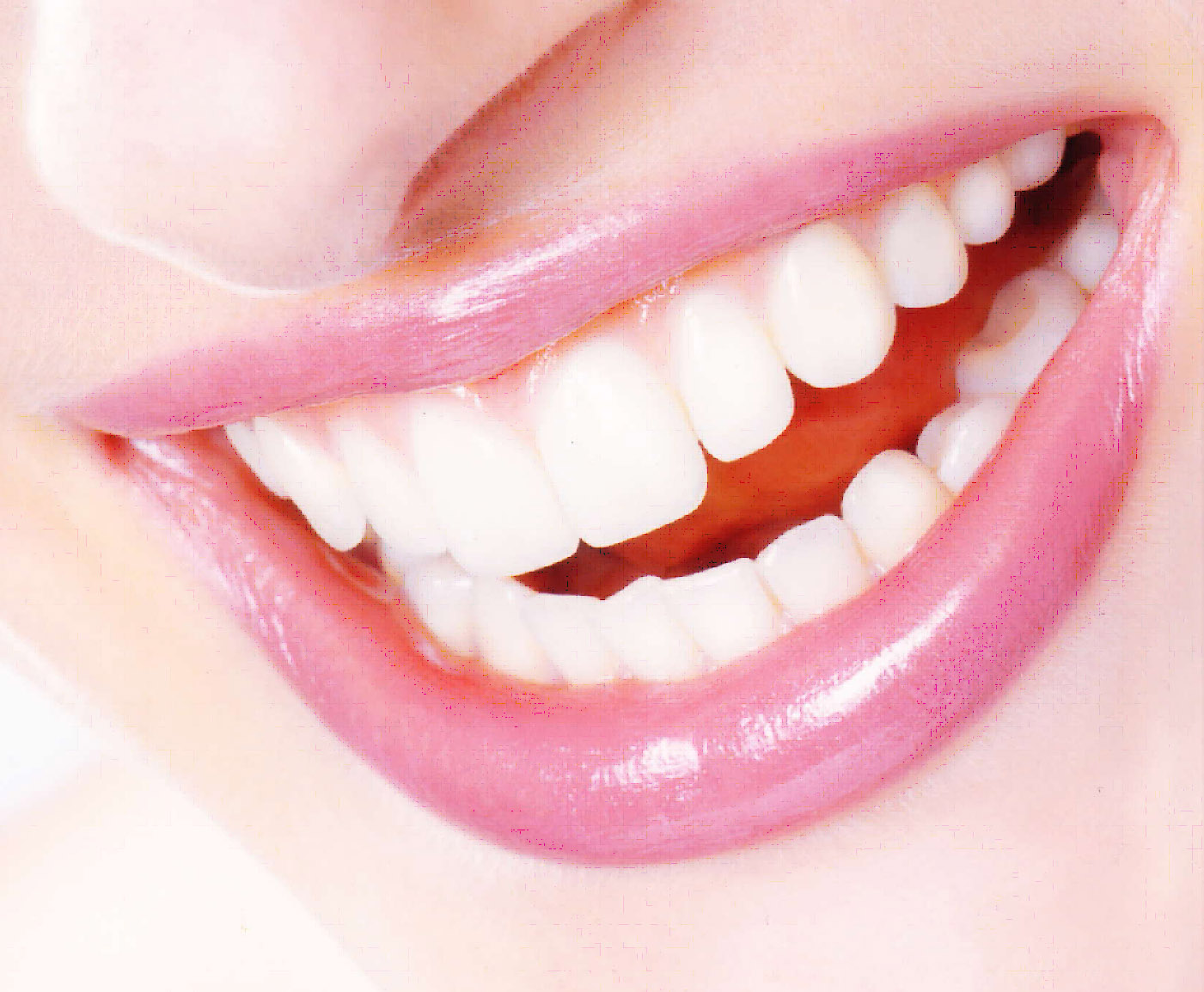Strahlendes Lachen Mund Zähne Lachender Mund rosa Lippen